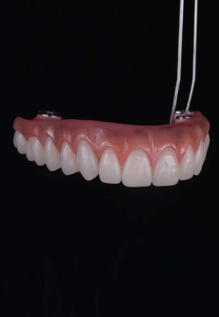 zigomatico-6